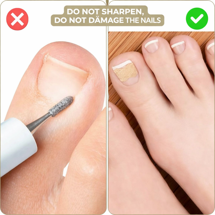 Toenail Corrector Patches Ingrown Nail Treatment
