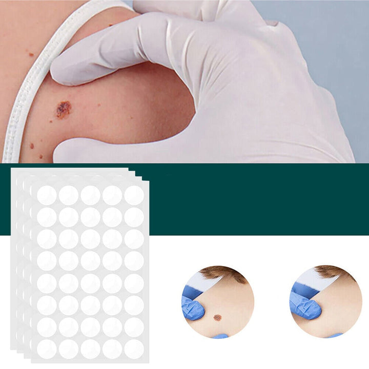 Skin Tag Remover Hydrocolloid Patches