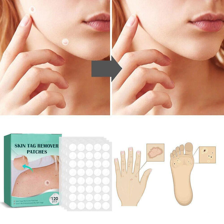 Skin Tag Remover Hydrocolloid Patches